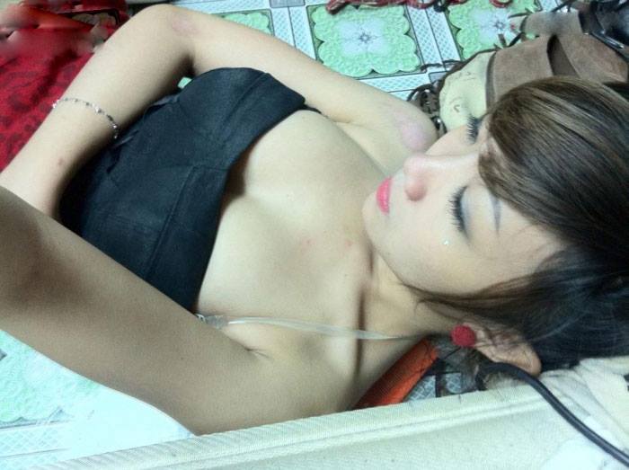 Mông ngực phải gọi là căng đét